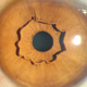 Image: S. Li and L. Liang/NEJM